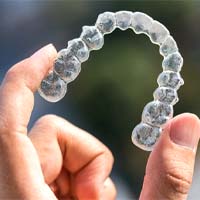 Clear Aligners aligner in South Elgin