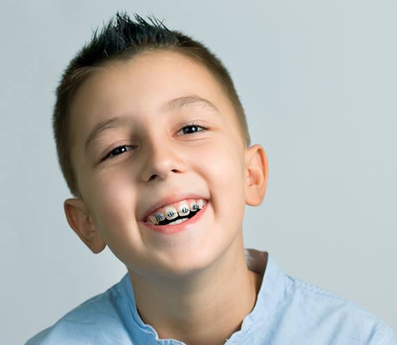 Boy smiles during Phase 1 orthodontic treatment in South Elgin, IL