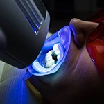 Patient receiving in-office teeth whitening 